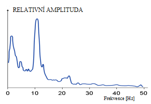 Obrázek 2 Frekvenční spektrum normálního EEG (převzato z [18]) Ke snímání signálu EEG se používá 21 elektrodový systém, kde 19 z nich je umístěno symetricky nad hemisférami a zbylé dvě elektrody na