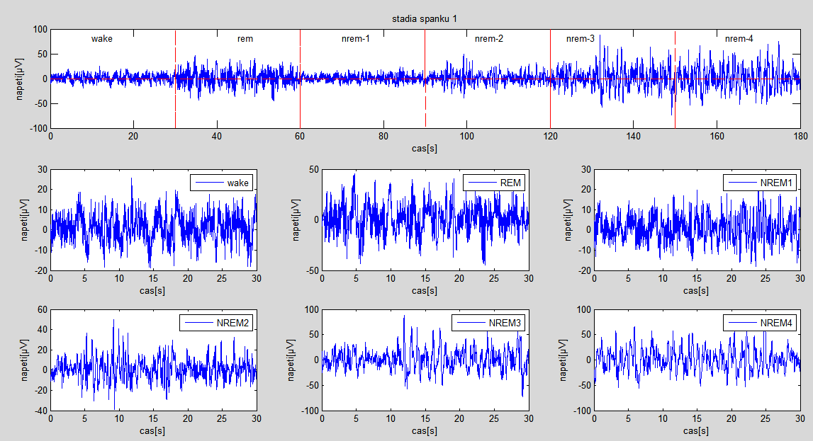 V začátku bylo v programu Matlab načteno 59 epoch od 1 pacienta ze spánkových fází (wake, REM a NREM). V každé načtené epoše je uložena matice s velikosti 1x300.