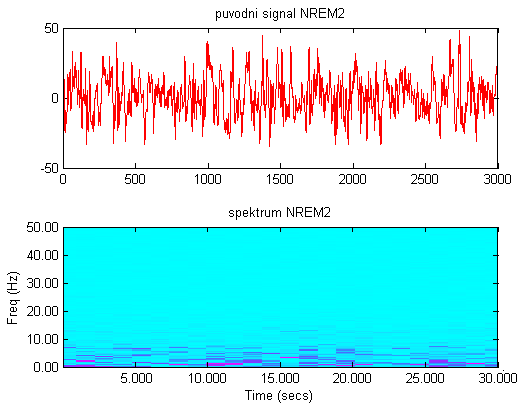 Obrázek 32 Původní signál NREM2 a jeho spektrum Po výběru vlnky db4 a úrovně 7 byla vlnková transformace aplikována na 30 sekundové epochy EEG signálu.