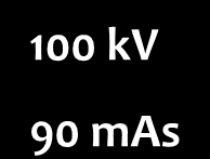 šumu 100 kv 90