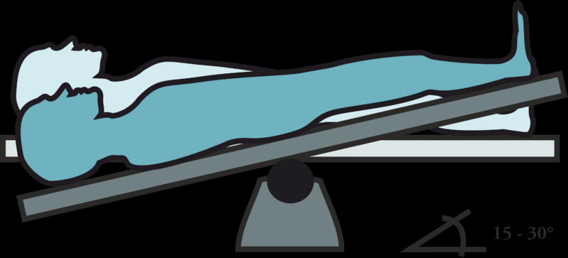 Trendelenburgova