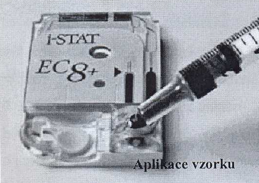 i-stat ruční přístroj, analýza v místě odběru vzorku multikanálový elektrochemický biosensor, poskytuje informace o klíčových látkách, analyzovaných