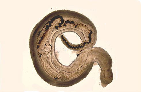 Schistosoma haematobium (krevnička