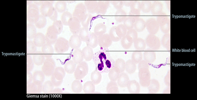 Trypanosoma brucei spavá nemoc, přenašečem moucha