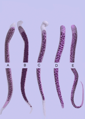 Obrázky převzaty z CD-ROM Parasite-Tutor Department of Laboratory Medicine, University of Washington,
