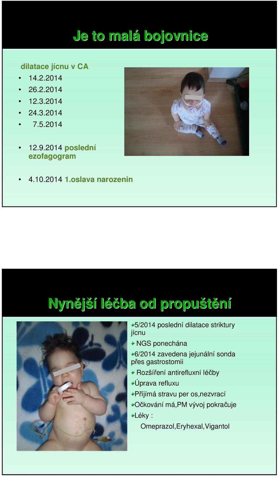 oslava narozenin Nynější léčba od propuštění 5/2014 poslední dilatace striktury jícnu NGS ponechána