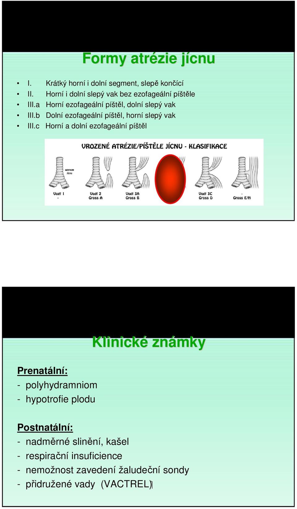 b Dolní ezofageální píštěl, horní slepý vak III.