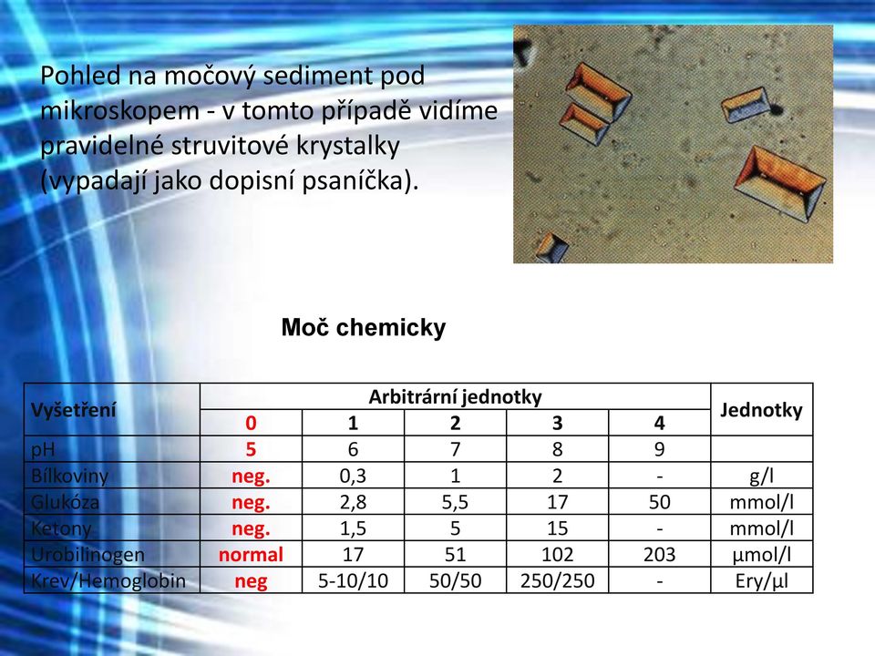 Moč chemicky Vyšetření Arbitrární jednotky 0 1 2 3 4 Jednotky ph 5 6 7 8 9 Bílkoviny neg.