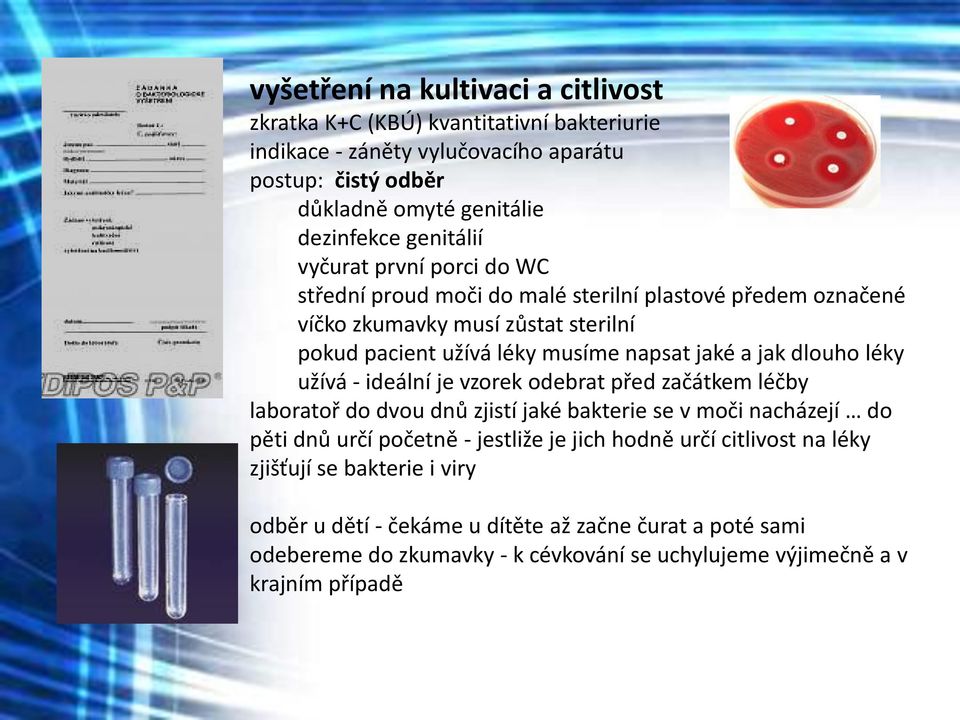 jak dlouho léky užívá - ideální je vzorek odebrat před začátkem léčby laboratoř do dvou dnů zjistí jaké bakterie se v moči nacházejí do pěti dnů určí početně - jestliže je jich