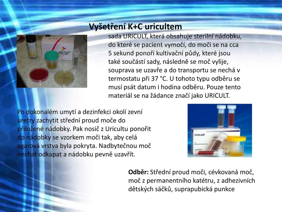 sada URICULT, která obsahuje sterilní nádobku, do které se pacient vymočí, do moči se na cca 5 sekund ponoří kultivační půdy, které jsou také součástí sady, následně se moč vylije, souprava