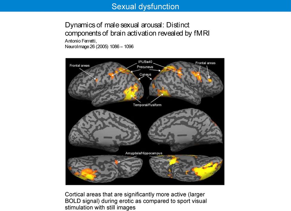 1086 1096 Cortical areas that are significantly more active (larger BOLD