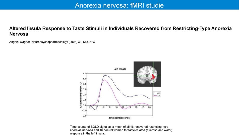 (2008) 33, 513 523 Time course of BOLD signal as a mean of all 16 recovered restricting-type