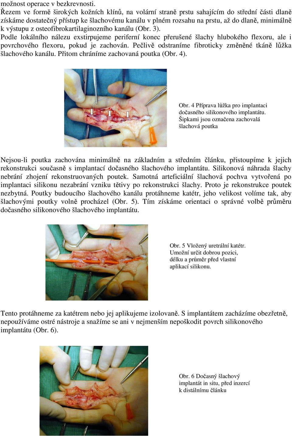 výstupu z osteofibrokartilaginozního kanálu (Obr. 3). Podle lokálního nálezu exstirpujeme periferní konec přerušené šlachy hlubokého flexoru, ale i povrchového flexoru, pokud je zachován.