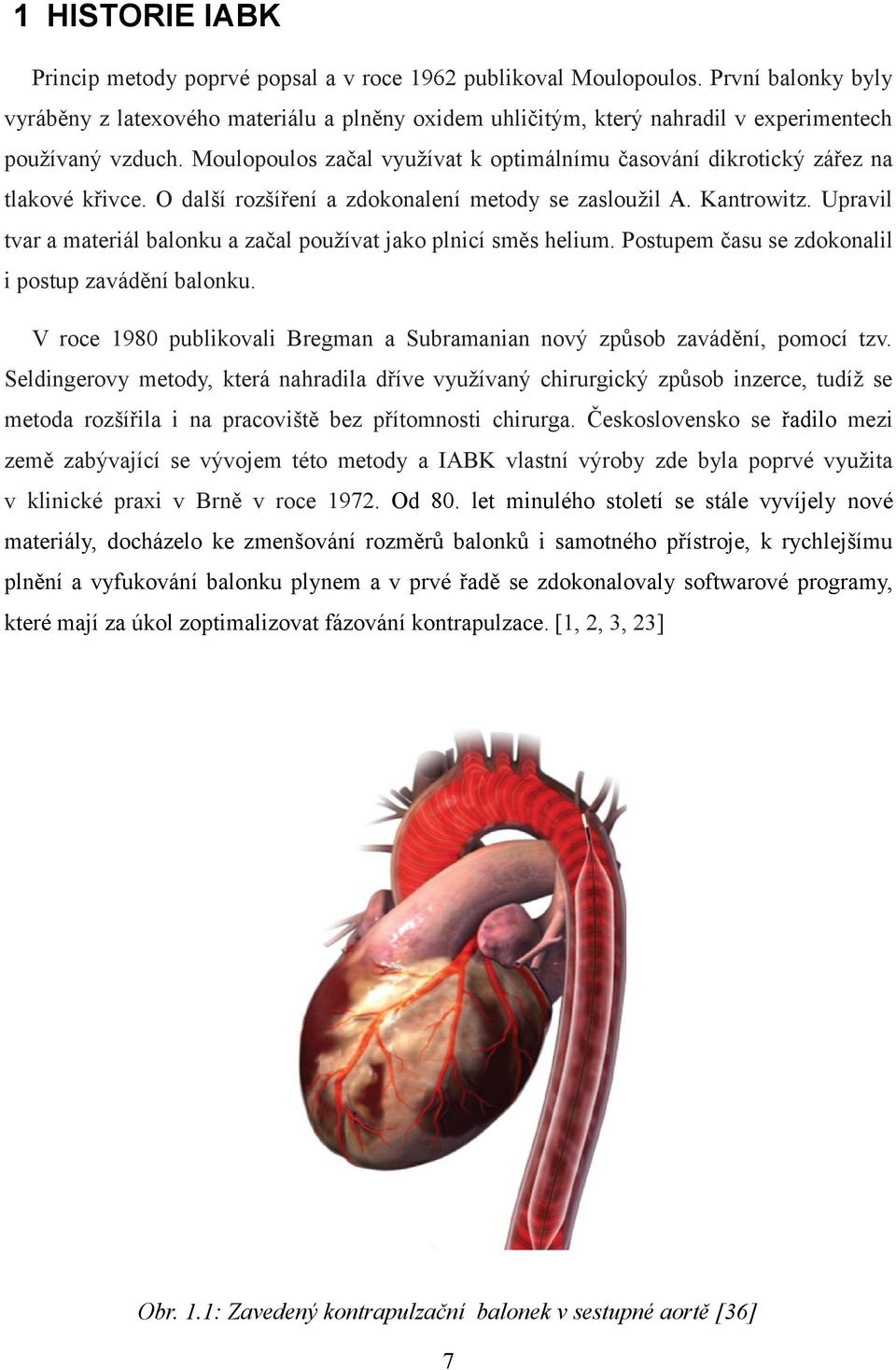 Moulopoulos začal využívat k optimálnímu časování dikrotický zářez na tlakové křivce. O další rozšíření a zdokonalení metody se zasloužil A. Kantrowitz.