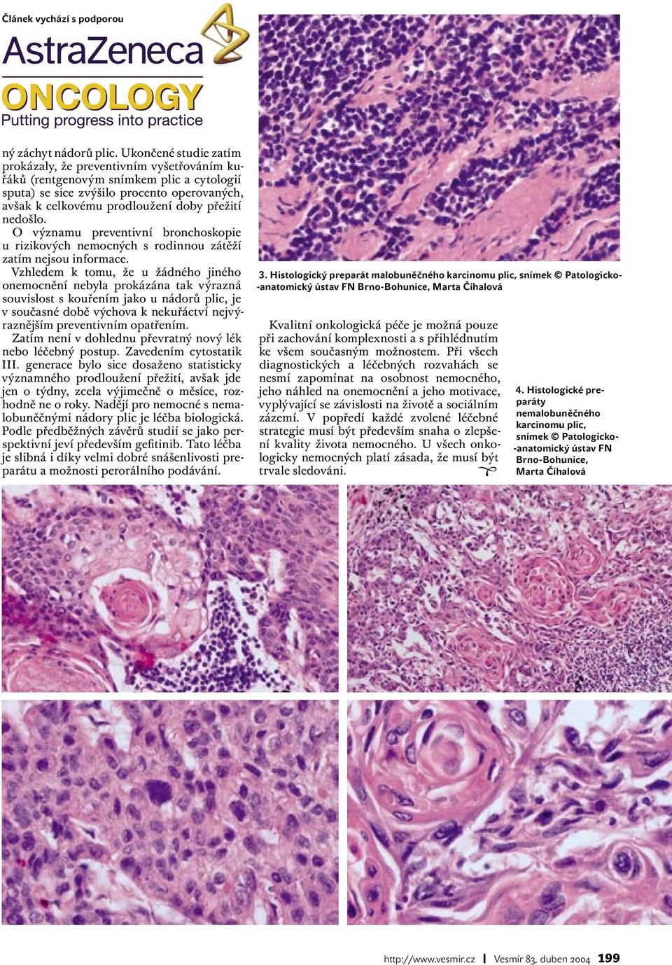 nedošlo. O významu preventivní bronchoskopie u rizikových nemocných s rodinnou zátěží zatím nejsou informace.