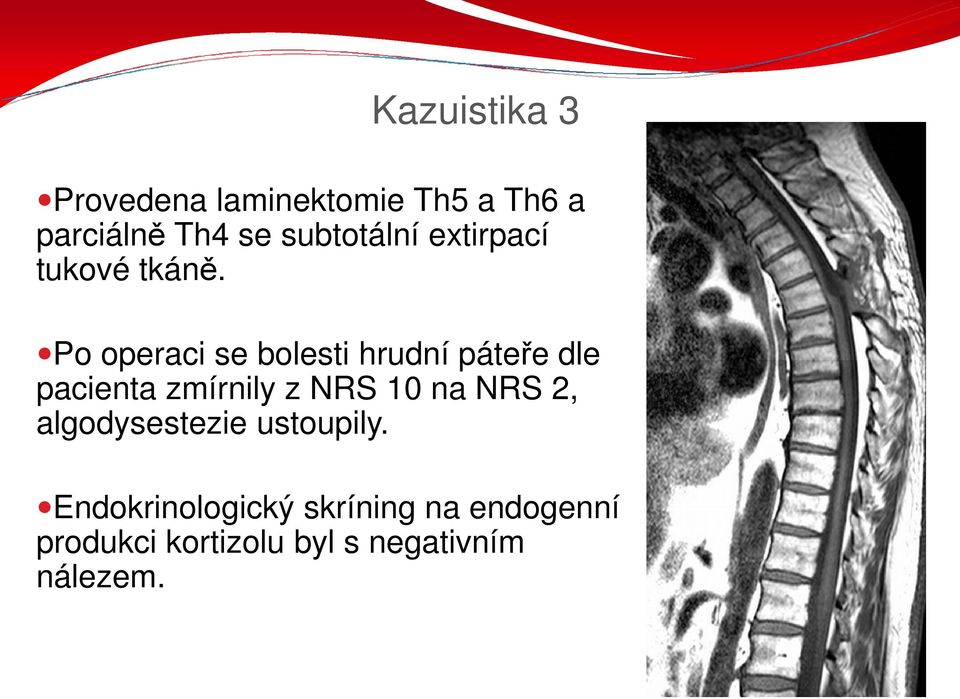 Po operaci se bolesti hrudní páteře dle pacienta zmírnily z NRS 10 na