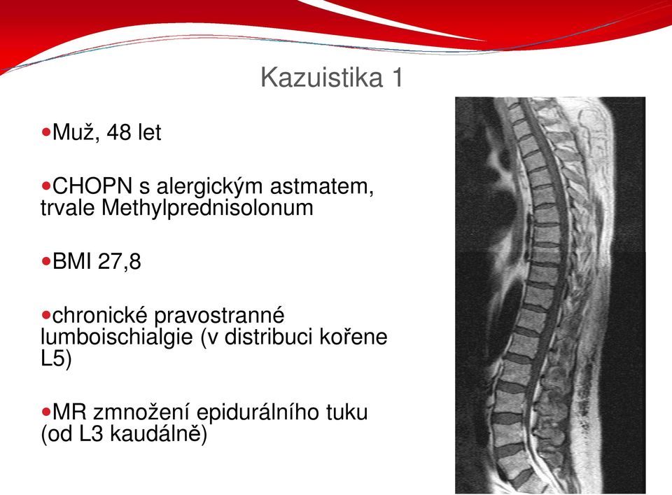 chronické pravostranné lumboischialgie (v