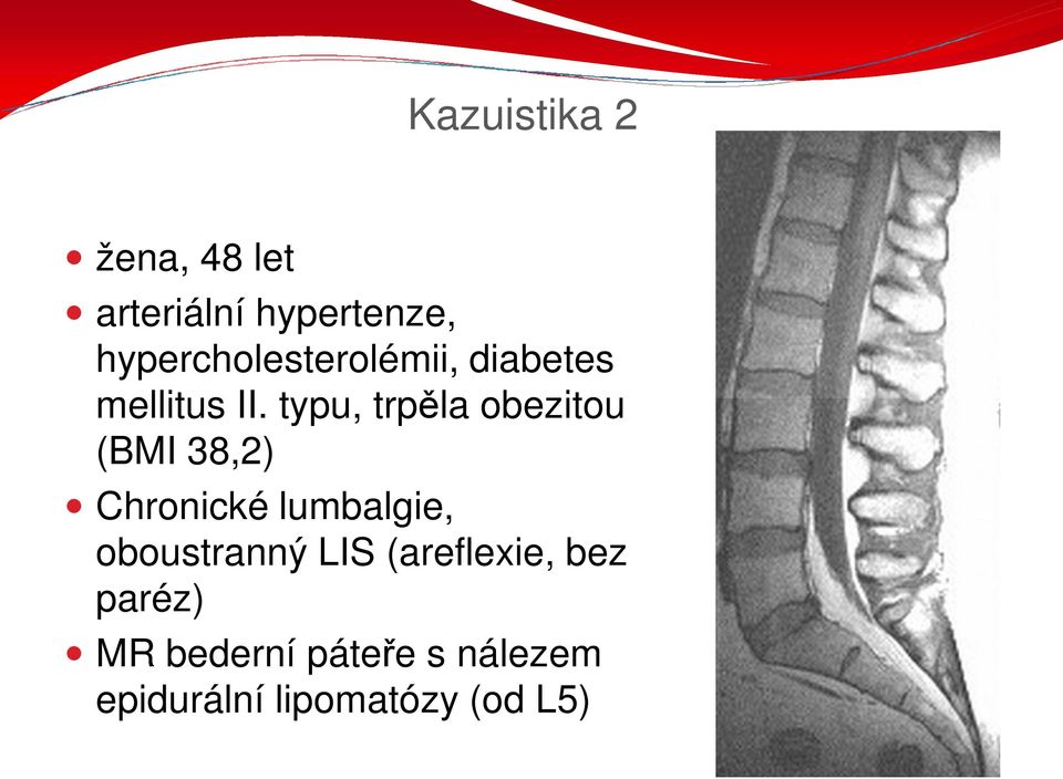 typu, trpěla obezitou (BMI 38,2) Chronické lumbalgie,