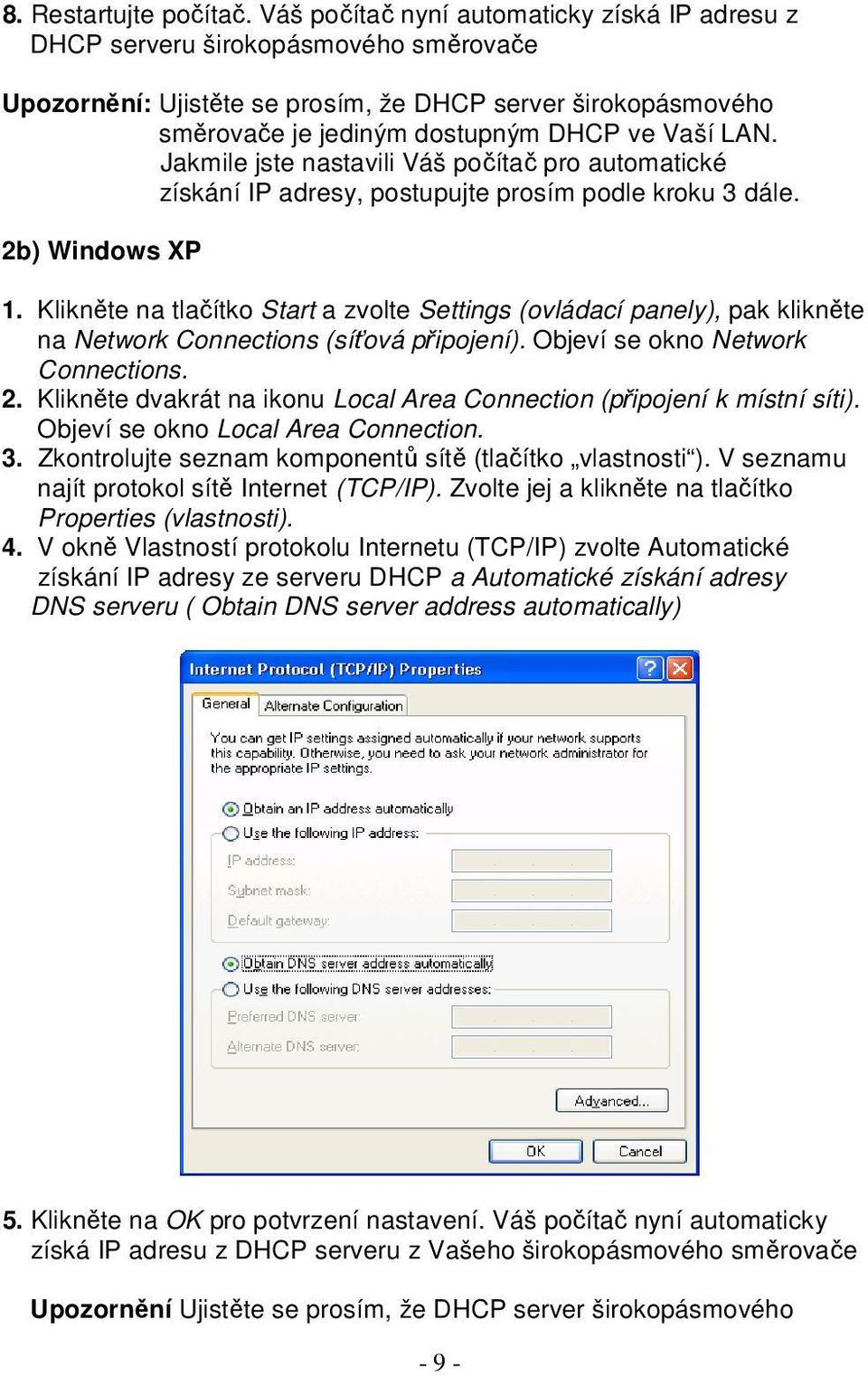 Jakmile jste nastavili Váš počítač pro automatické získání IP adresy, postupujte prosím podle kroku 3 dále. 2b) Windows XP 1.