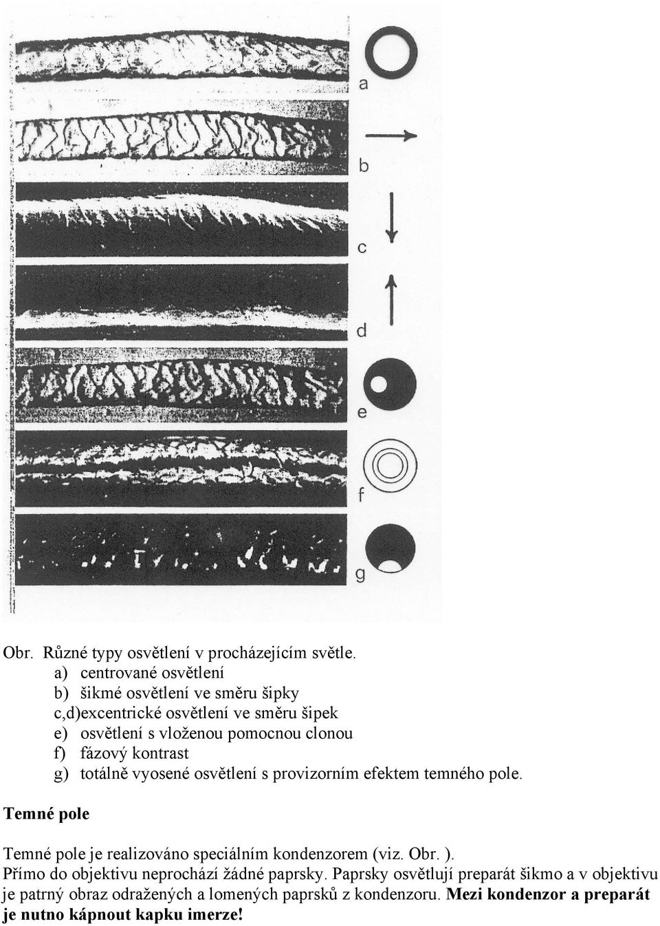 f) fázový kontrast g) totálně vyosené osvětlení s provizorním efektem temného pole.