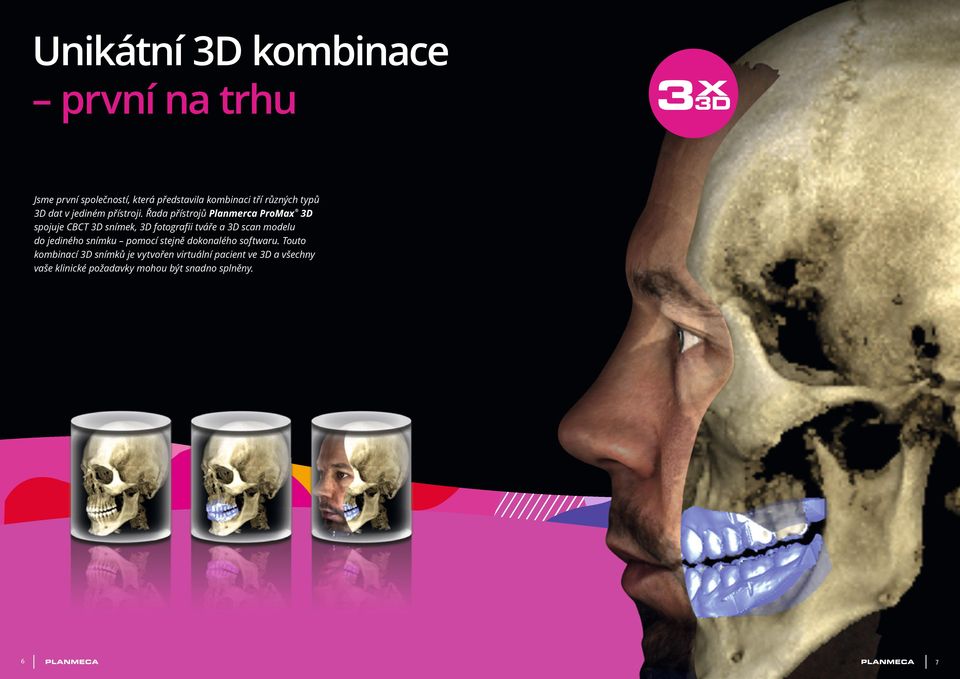 Řada přístrojů Planmerca ProMax 3D spojuje CBCT 3D snímek, 3D fotografii tváře a 3D scan modelu do
