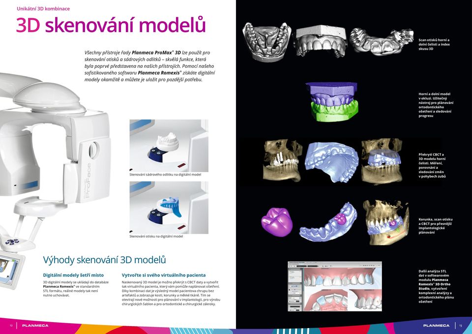 Scan otisků horní a dolní čelisti a index skusu 3D Horní a dolní model v okluzi.