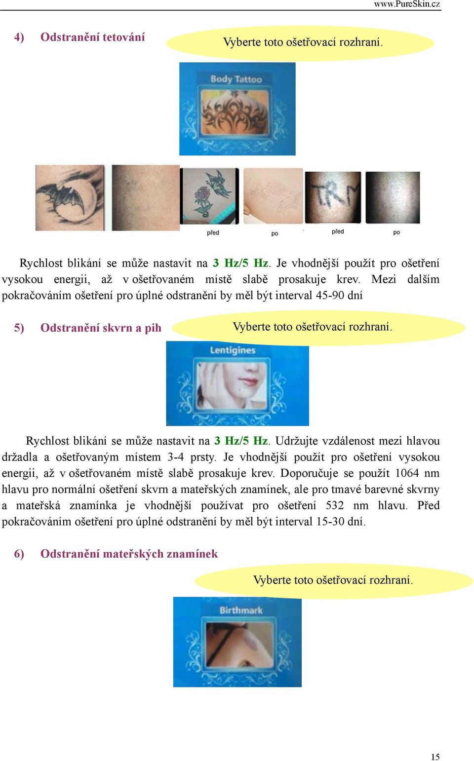 Mezi dalším pokračováním ošetření pro úplné odstranění by měl být interval 45-90 dní 5) Odstranění skvrn a pih Vyberte toto ošetřovací rozhraní. Rychlost blikání se může nastavit na 3 Hz/5 Hz.