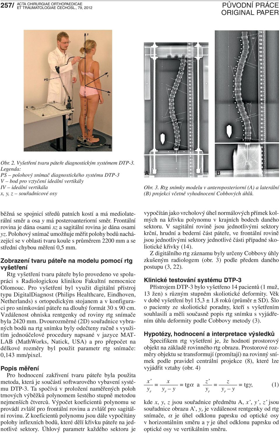 Rtg snímky modelu v anteroposteriorní (A) a laterální (B) projekci včetně vyhodnocení Cobbových úhlů.