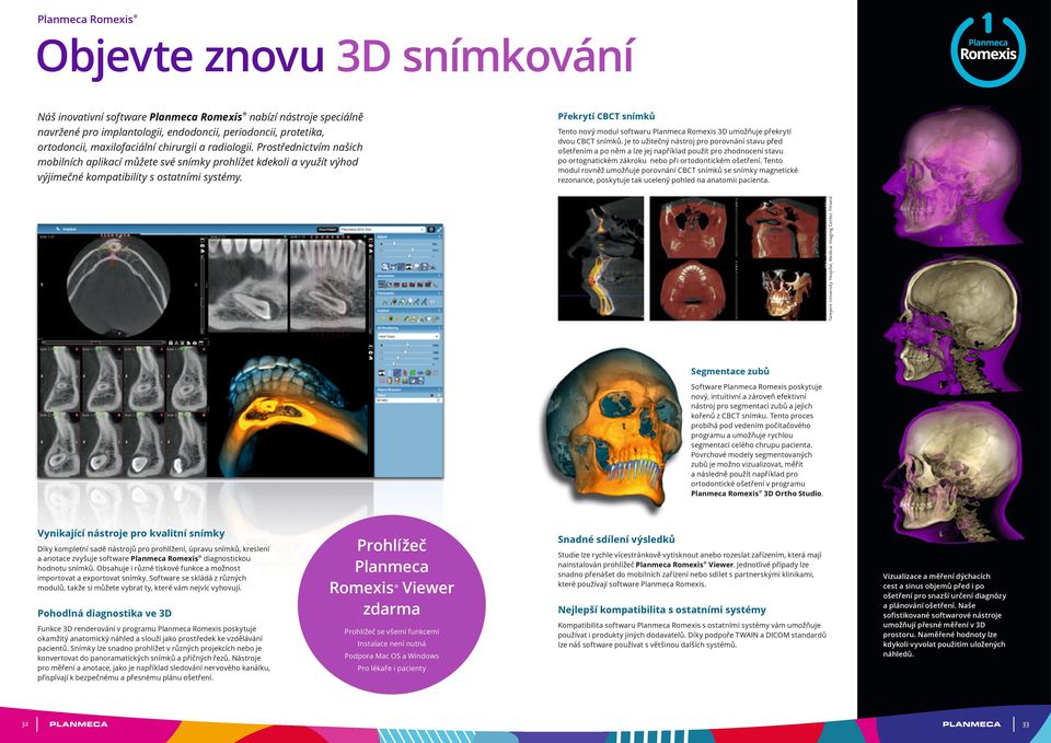 Překrytí CBCT snímků Tento nový modul softwaru Planmeca Romexis 3D umožňuje překrytí dvou CBCT snímků.