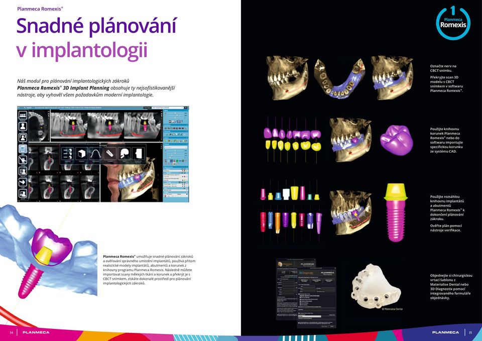 Překryjte scan 3D modelu s CBCT snímkem v softwaru Planmeca Romexis. Použijte knihovnu korunek Planmeca Romexis nebo do softwaru importujte specifickou korunku ze systému CAD.