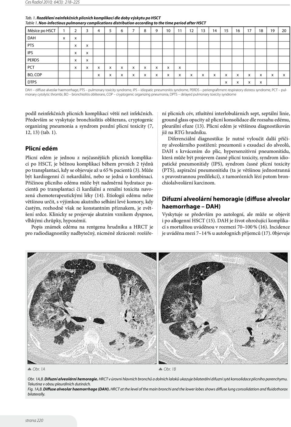 x x x x x x x x BO, COP x x x x x x x x x x x x x x x x x DTPS x x x x DAH diffuse alveolar haemorrhage, PTS pulmonary toxicity syndrome, IPS idiopatic pneumonitis syndrome, PERDS periengraftment