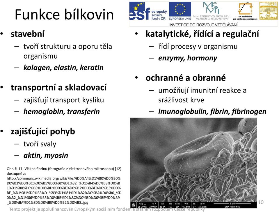 myosin Obr. č. 11: Vlákna fibrinu (fotografie z elektronového mikroskopu) [12] dostupné z: http://commons.wikimedia.