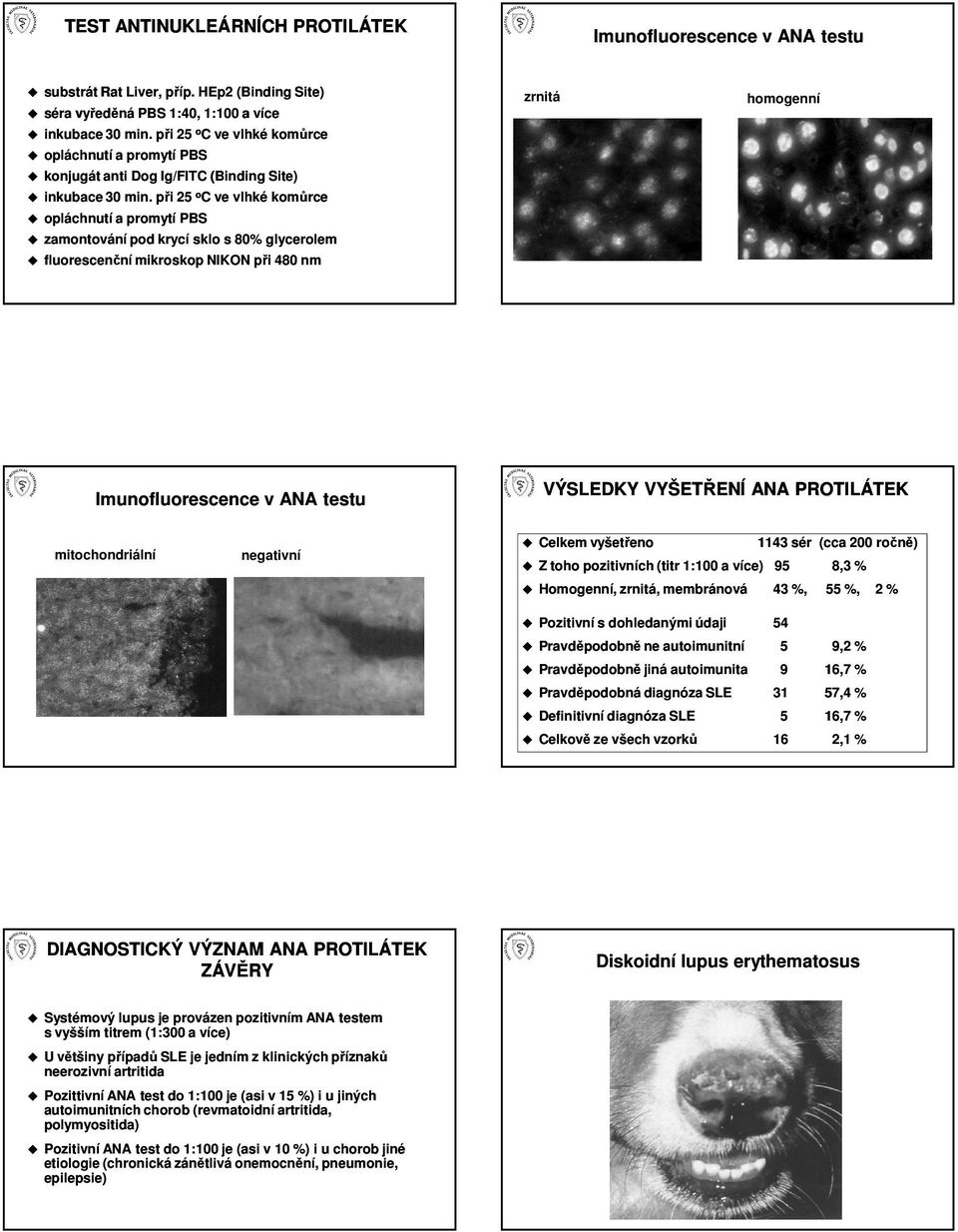 při 25 oc ve vlhké komůrce opláchnutí a promytí PBS zamontování pod krycí sklo s 80% glycerolem fluorescenční mikroskop NIKON při 480 nm Imunofluorescence v ANA testu mitochondriální VÝSLEDKY