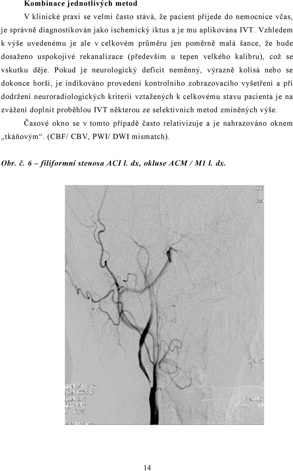 Pokud je neurologický deficit neměnný, výrazně kolísá nebo se dokonce horší, je indikováno provedení kontrolního zobrazovacího vyšetření a při dodržení neuroradiologických kriterií vztažených k