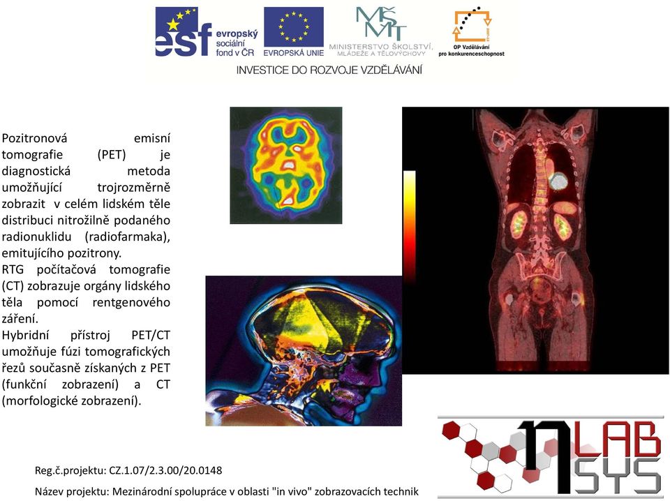 RTG počítačová tomografie (CT) zobrazuje orgány lidského těla pomocí rentgenového záření.