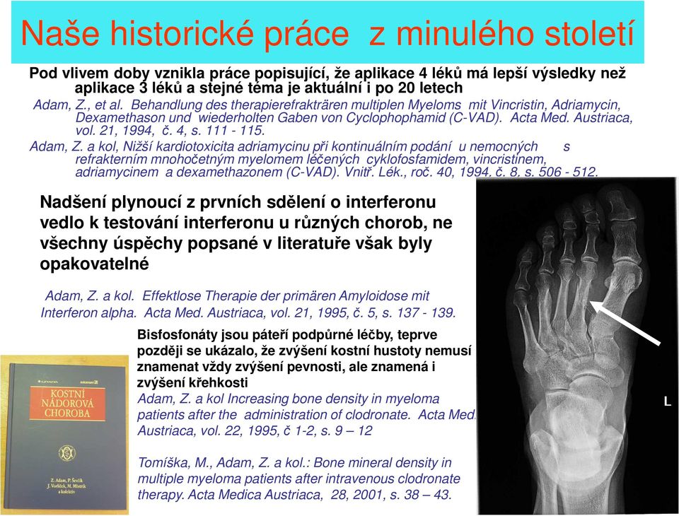 Adam, Z. a kol, Nižší kardiotoxicita adriamycinu při kontinuálním podání u nemocných s refrakterním mnohočetným myelomem léčených cyklofosfamidem, vincristinem, adriamycinem a dexamethazonem (C-VAD).