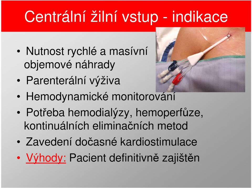 Potřeba hemodialýzy, hemoperfůze, kontinuálních eliminačních