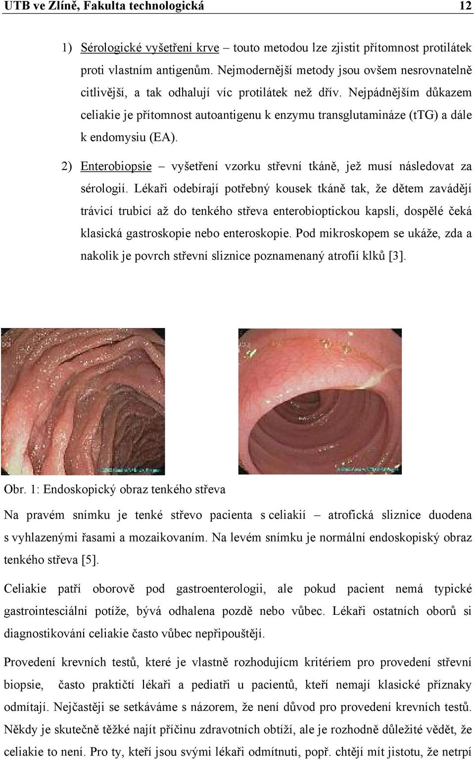 Nejpádnějším důkazem celiakie je přítomnost autoantigenu k enzymu transglutamináze (ttg) a dále k endomysiu (EA). 2) Enterobiopsie vyšetření vzorku střevní tkáně, jež musí následovat za sérologií.