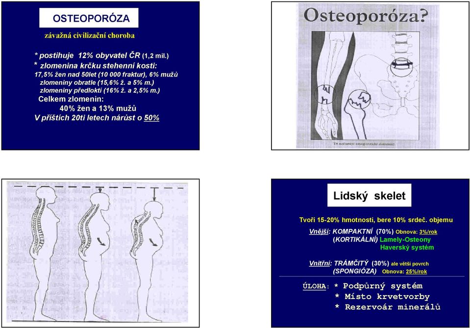 a 2,5% m.) Celkem zlomenin: 40% žen a 13% mužů V příštích 20ti letech nárůst o 50% Lidský skelet Tvoří 15-20% hmotnosti, bere 10% srdeč.