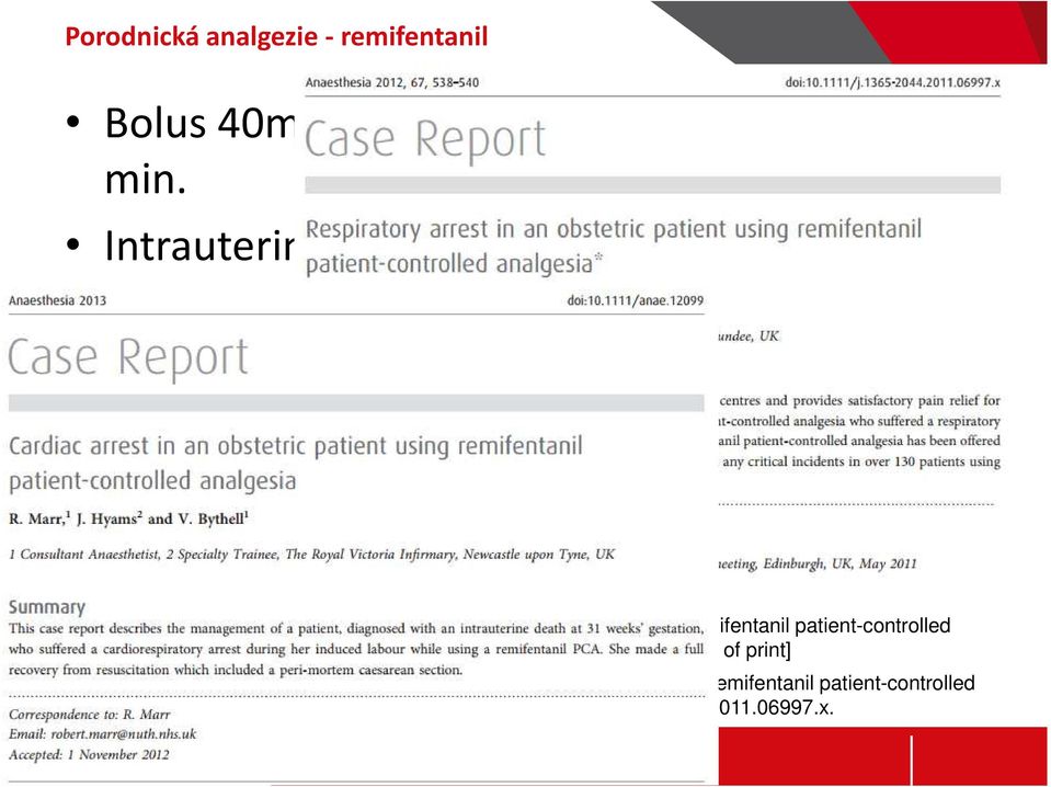 : Cardiac arrest in an obstetric patient using remifentanil patient-controlled analgesia. Anaesthesia. 2013 Jan 7. doi: 10.1111/anae.12099.