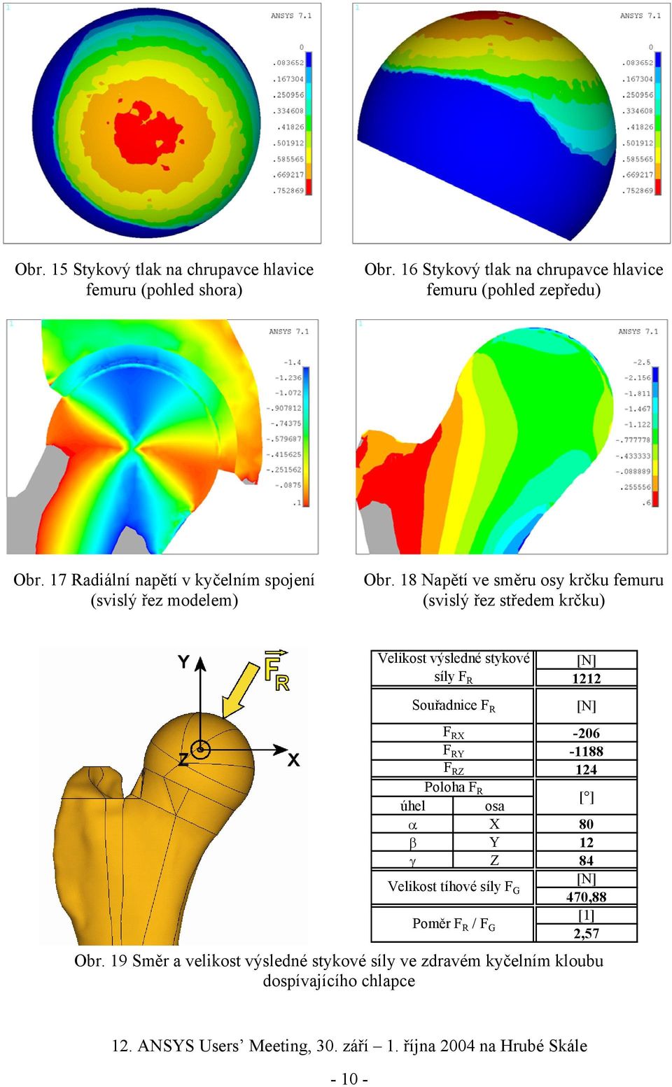 18 Napětí ve směru osy krčku femuru (svislý řez středem krčku) Velikost výsledné stykové síly F R Souřadnice F R F RX F RY F RZ 1212-206