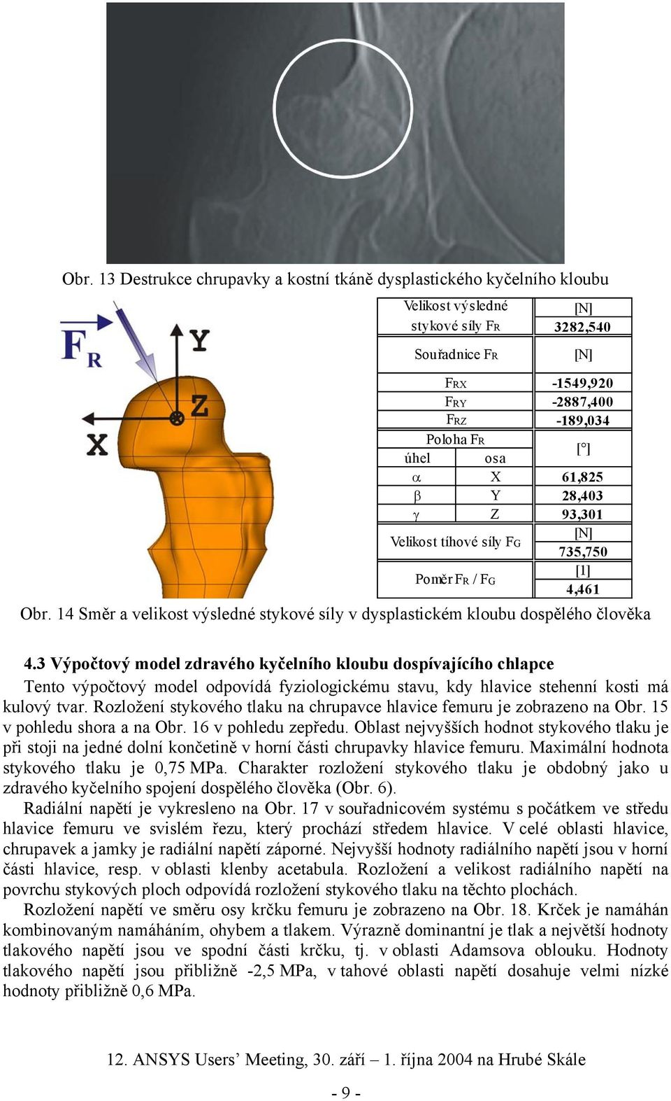 3 Výpočtový model zdravého kyčelního kloubu dospívajícího chlapce Tento výpočtový model odpovídá fyziologickému stavu, kdy hlavice stehenní kosti má kulový tvar.