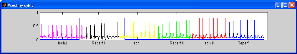 Obr. 8.10 Vývojový diagram činnosti aplikace Rozpoznavani_GUI Obr. 8.11 Pomocné GUI - zobrazení všech cyklů Zobrazení cyklů ze všech fází experimentu do jednoho okna grafu je dost nepřehledné.