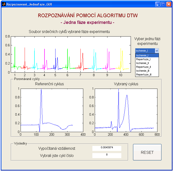 Obr. 8.13 Grafické rozhraní Rozpoznávání_JednaFaze_GUI Úspěšnost správného rozhodování je stejně jako u předchozí aplikace posuzována pomocí senzitivity. Výsledky jsou uvedeny v tabulce 8.2.