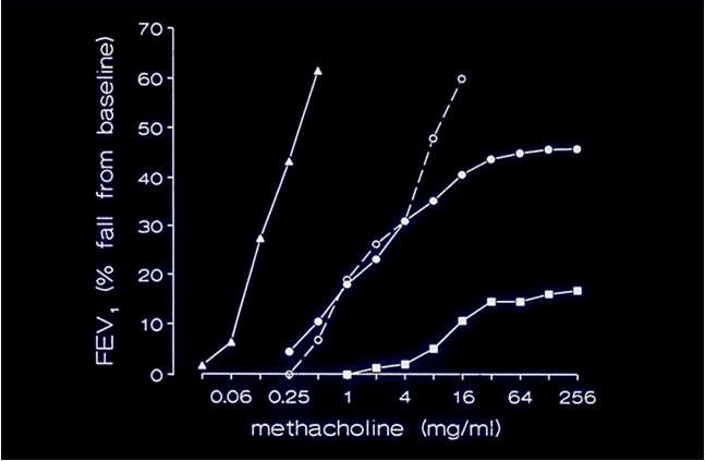 Bronchial Hyperresponsiveness: Abnormal Airway Smooth Muscle? Bronchodilatační testy- BDT Salbutamol 400 ug, hodnocení po min.