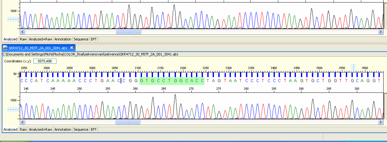 Cycle Sequencing Kit (APPLIED BIOSYSTEMS) -primer A, reagent Ready Reaction Mix -Teplotní profil sekvenační reakce: 95/1 -