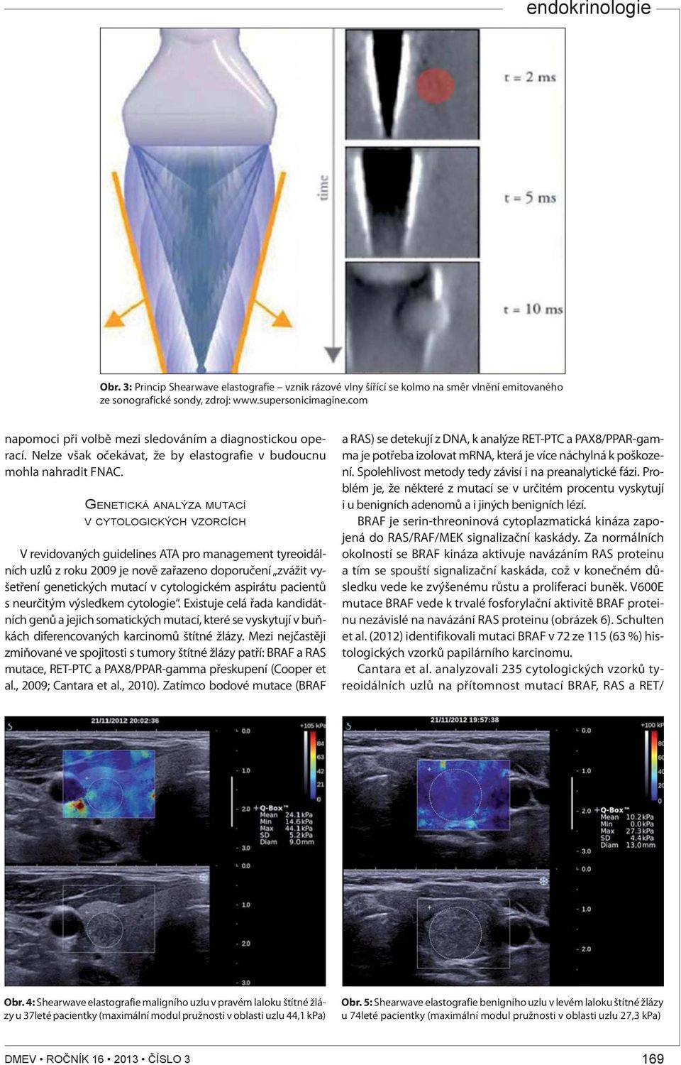 GENETICKÁ ANALÝZA MUTACÍ V CYTOLOGICKÝCH VZORCÍCH V revidovaných guidelines ATA pro management tyreoidálních uzlů z roku 2009 je nově zařazeno doporučení zvážit vyšetření genetických mutací v