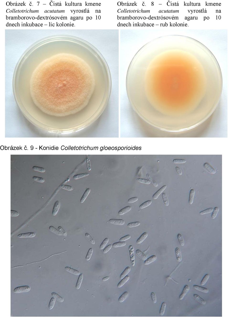 bramborovo-dextrósovém agaru po 10 dnech inkubace líc kolonie.