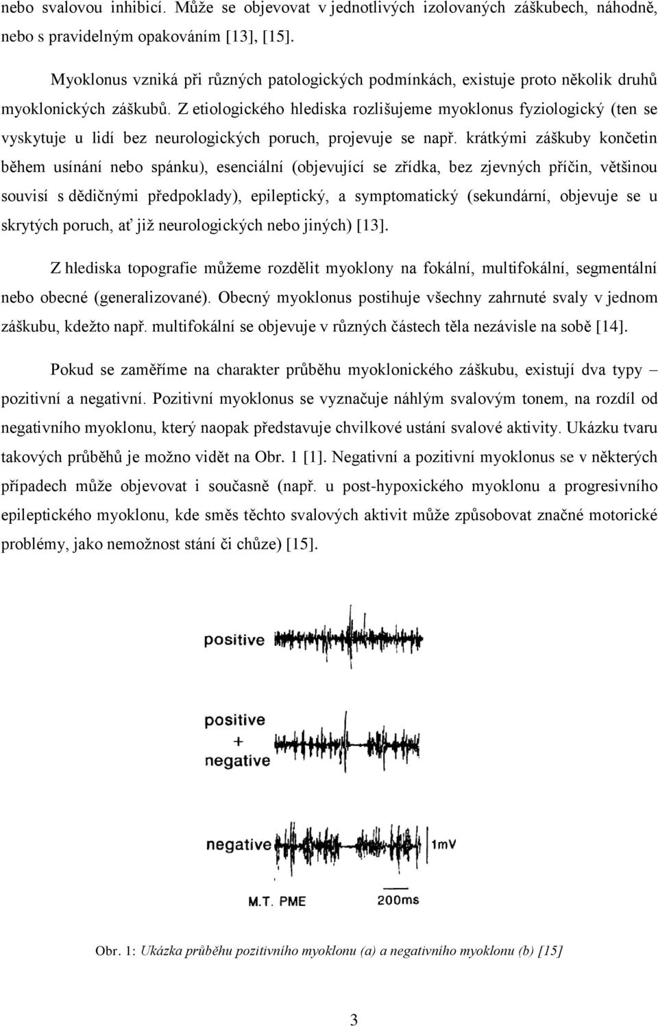 Z etiologického hlediska rozlišujeme myoklonus fyziologický (ten se vyskytuje u lidí bez neurologických poruch, projevuje se např.