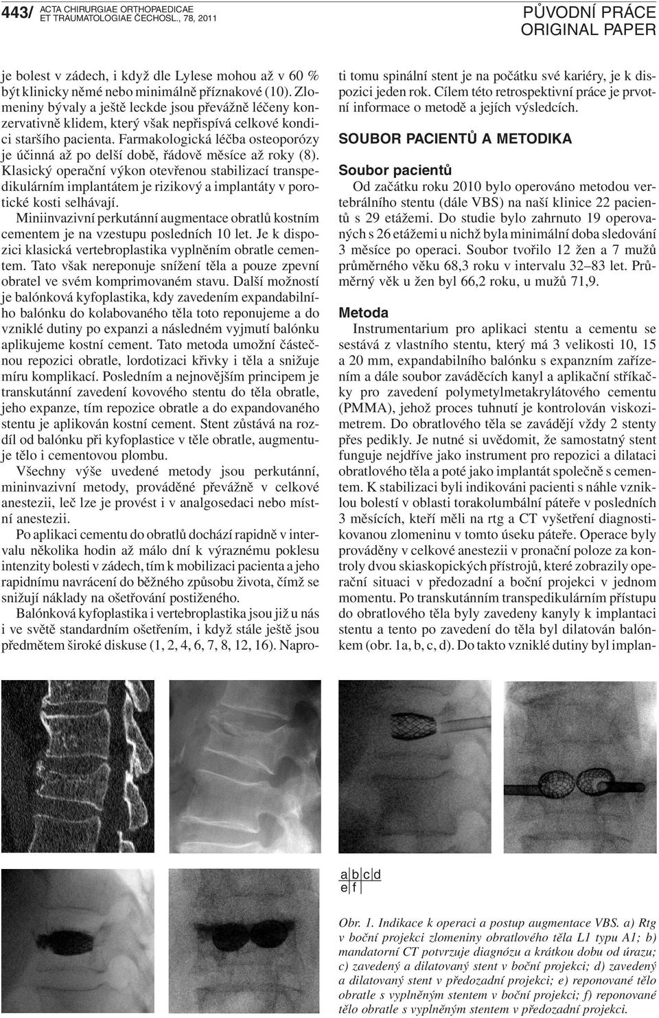 Farmakologická léčba osteoporózy je účinná až po delší době, řádově měsíce až roky (8).